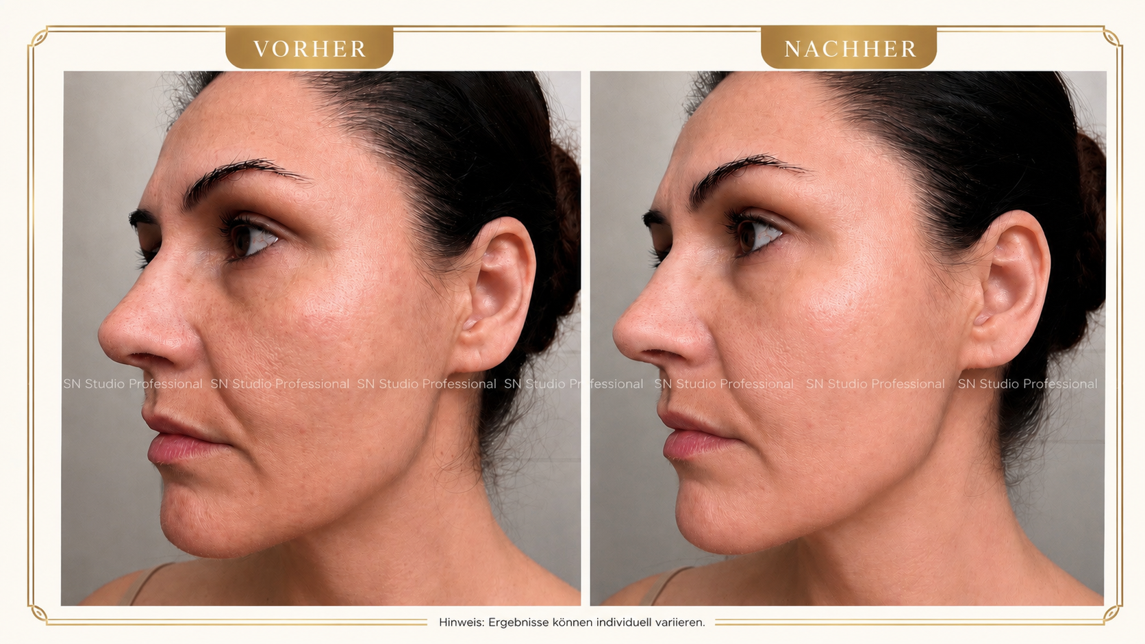 BIO HELIX SCHLEIM GESICHT VOR-NACHHER Vorheriger Vergleich nach der Anwendung des Bio Helix-Schleims mit Peeling und dem leuchtendsten Effekt